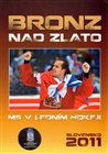 Bronz nad zlato