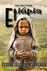 Etiópia