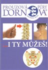 Dornova metoda