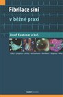 Fibrilace síní v běžné praxi