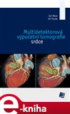 Multidetektorová výpočetní tomografie srdce - obálka