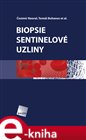 Biopsie sentinelové uzliny