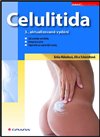 Celulitida