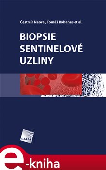 Levně Biopsie sentinelové uzliny - Čestmír Neoral, Tomáš Bohanec e-kniha