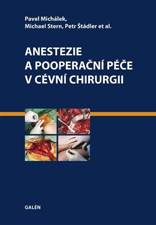 Anestezie a pooperační péče v cévní chirurgii - Petr Štádler, Pavel Michálek, Michael Stern