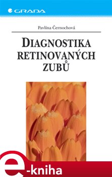 Levně Diagnostika retinovaných zubů - Pavlína Černochová e-kniha