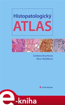 Levně Histopatologický atlas - Svetlana Brychtová, Alice Hlobilková e-kniha