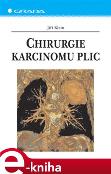 Levně Chirurgie karcinomu plic - Jiří Klein e-kniha