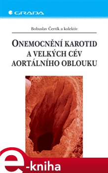 Levně Onemocnění karotid a velkých cév aortálního oblouku - Bohuslav Čertík e-kniha
