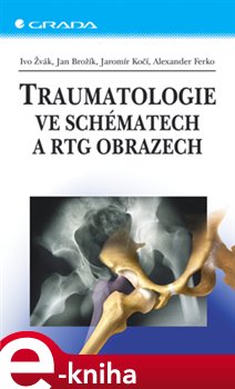 Levně Traumatologie ve schématech a RTG obrazech - Ivo Žvák, Jan Brožík, Jaromír Kočí, Alexander Ferko e-kniha