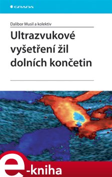 Levně Ultrazvukové vyšetření žil dolních končetin - Dalibor Musil e-kniha