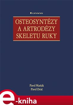 Levně Osteosyntézy a artrodézy skeletu ruky - Pavel Maňák, Pavel Dráč e-kniha
