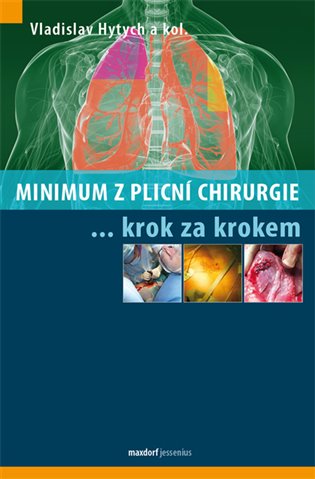 Minimum z plicní chirurgie krok za krokem - kol., Vladislav Hytych