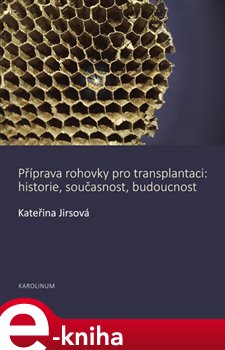 Levně Příprava rohovky pro transplantaci - Kateřina Jirsová e-kniha