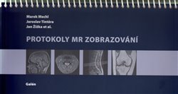 Levně Protokoly MR Zobrazování - Marek Mechl, Jaroslav Tintěra, Jan Žižka
