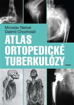 Levně Atlas ortopedické tuberkulózy - Miroslav Netval, Dalimil Chocholáč