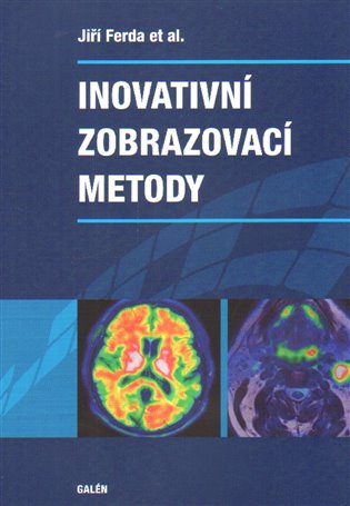 Inovativní zobrazovací metody - Jiří Ferda, kol.