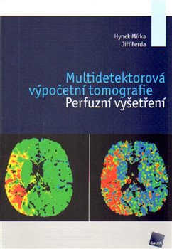 Levně Multidetektorová výpočetní tomografie. Perfuzní vyšetření - Jiří Ferda, Hynek Mírka