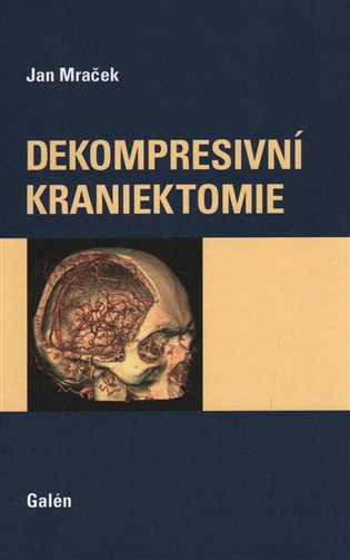 Dekompresivní kraniektomie - Jan Mraček