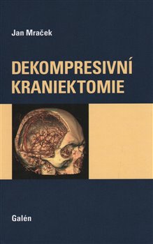 Dekompresivní kraniektomie