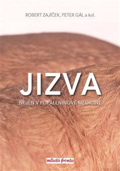 Levně Jizva nejen v popáleninové medicíně - Robert Zajíček, Peter Gál