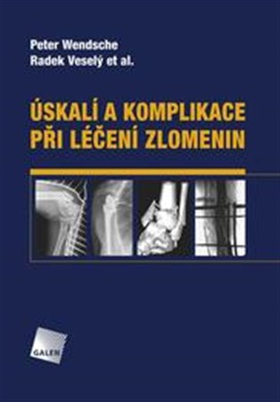 Úskalí a komplikace při léčení zlomenin - kol., Radek Veselý, Peter Wendsche