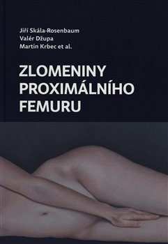 Levně Zlomeniny proximálního femuru - Jiří Skála Rosenbaum, Valér Džupa, Martin Krbec