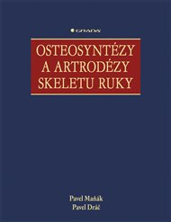 Osteosyntézy a artrodézy skeletu ruky - Pavel Dráč, Pavel Maňák