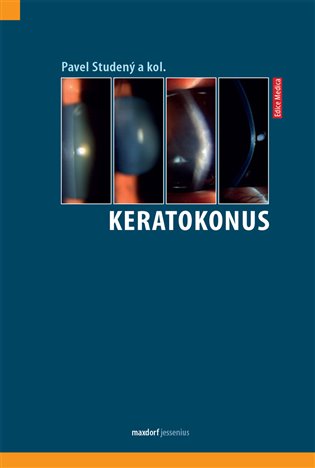 Keratokonus - Pavel Studený, kol.