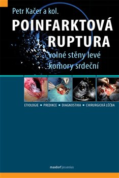 Poinfarktová ruptura volné stěny levé komory srdeční koupíte na Kosmas.cz