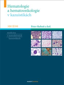 Hematologie a hematoonkologie v kazuistikách koupíte na Kosmas.cz