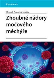 Zhoubné nádory močového měchýře - Alexandr Poprach,  kolektiv