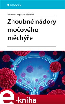Levně Zhoubné nádory močového měchýře - Alexandr Poprach, kolektiv