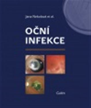 Oční infekce - Jana Nekolová