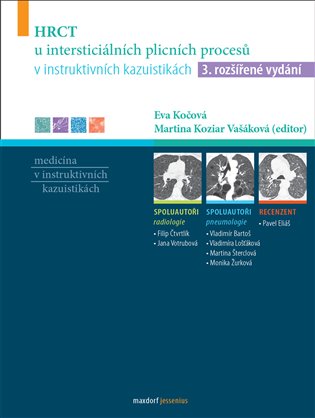 HRCT u intersticiálních plicních procesů v instruktivních kazuistikách - kol.