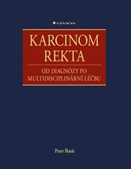 Karcinom rekta: od diagnózy po multidisciplinární léčbu - Peter Ihnát