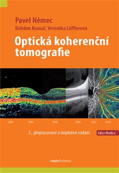 Optická koherenční tomografie koupíte na Kosmas.cz