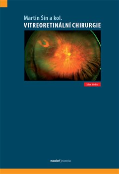 Vitreoretinální chirurgie koupíte na Kosmas.cz