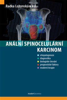 Anální spinocelulární karcinom koupíte na Kosmas.cz
