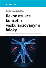 Rekonstrukce končetin vaskularizovanými laloky - Tomáš Kempný,  kol.