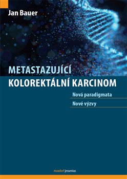 Metastazující kolorektální karcinom koupíte na Kosmas.cz