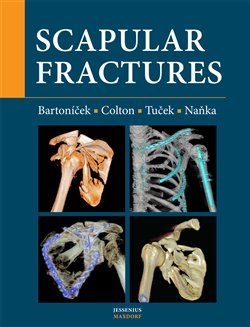 Scapular fractures koupíte na Kosmas.cz