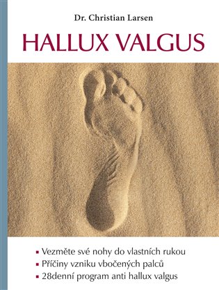 Hallux valgus - Christian Larsen