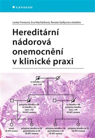 Hereditární nádorová onemocnění v klinické praxi - Lenka Foretová, Renata Gaillyová, Eva Macháčková,  kolektiv