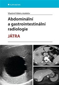 Abdominální a gastrointestinální radiologie - Játra - Vlastimil Válek,  kolektiv