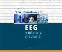 EEG v intenzivní medicíně koupíte na Kosmas.cz