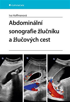 Abdominální sonografie žlučníku a žlučových cest koupíte na Kosmas.cz