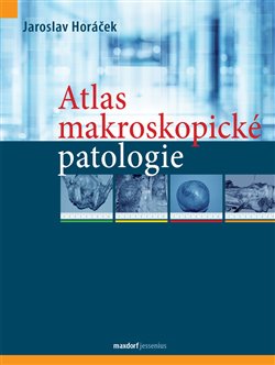 Atlas makroskopické patologie koupíte na Kosmas.cz