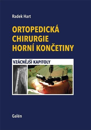 Ortopedická chirurgie horní končetiny: Vzácnější kapitoly - Radek Hart