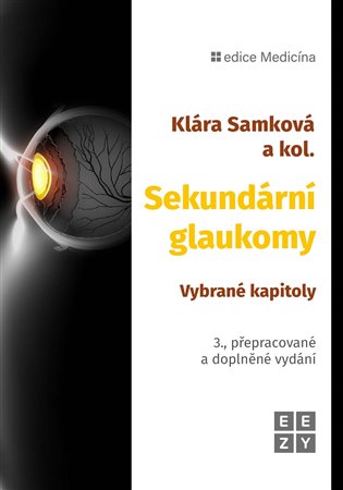 Sekundární glaukomy - Klára Samková, a kolektiv autorů